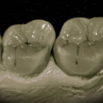 Figura 10