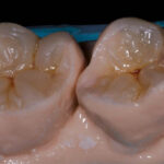 Figura 13
