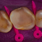 Figura 17