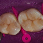 Figura 19