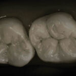 Figura 21